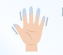 Priznaky-polyneuropatie-330x186-2-1.jpg